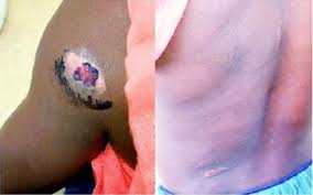 Brutalized housemaid, 8, wins N500k settlement against boss .