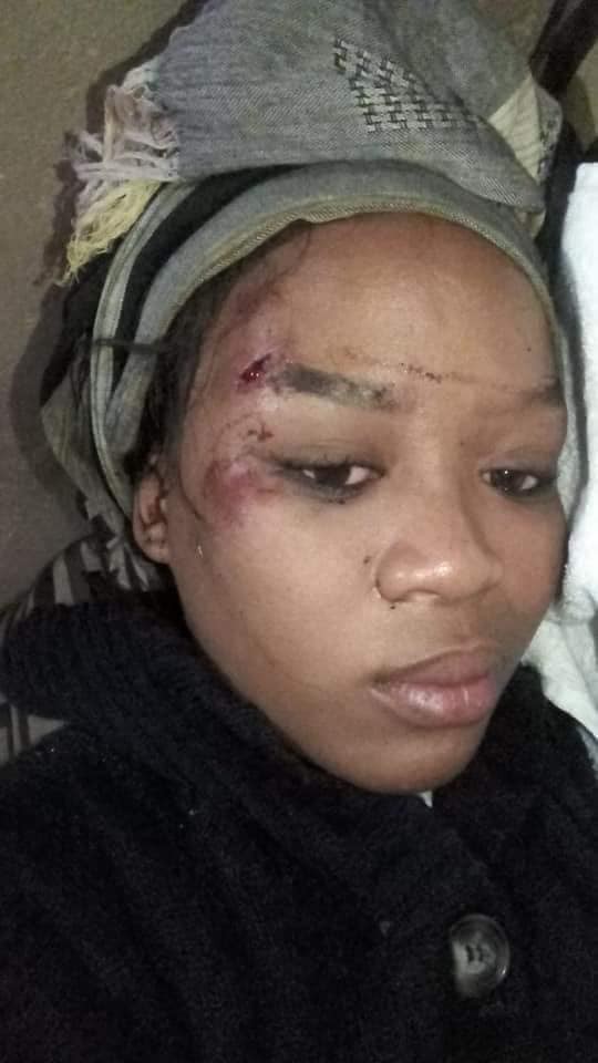 ‘How my husband of over 10 years ran over me with his car’ – South African woman shares disturbing story